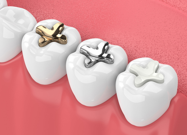 Three white tooth models displaying different orthodontic brackets and wires on pink background.