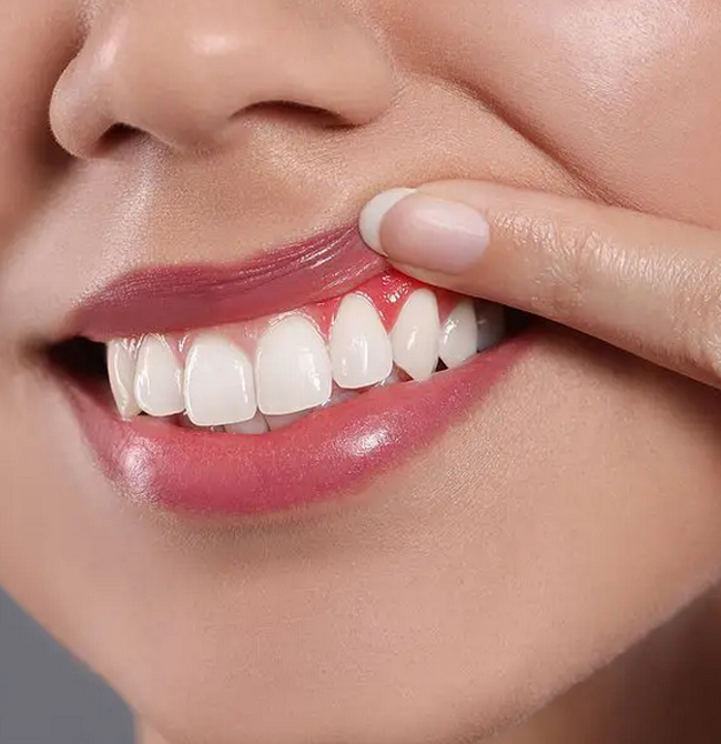 Close-up of person's smile showing bright white teeth and natural makeup application.
