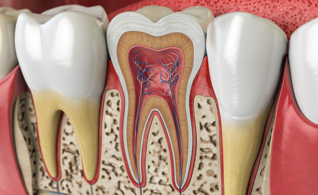 Dental cross-section diagram showing tooth structure with pulp, dentin, and enamel layers in gum tissue.
